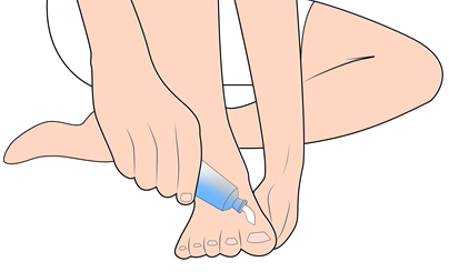 Fußpflege bei Diabetes